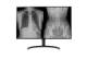 LG 32HL512D-M 81,3 cm ( 32 inch ) Diagnose-TFT 2xDP, HDMI, USB 3.0