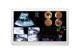 LG 81,3 cm ( 32 inch ) 32HL714S-W Surgical TFT DP,HDMI,USB 2.0 IPS 16:9